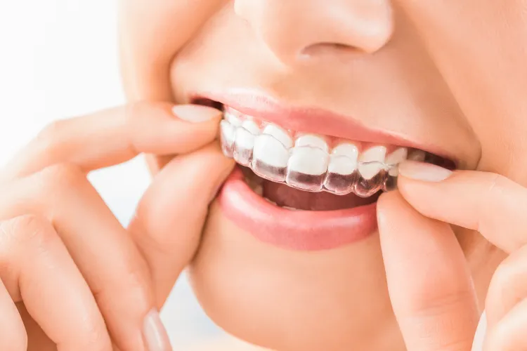 alinhadores-eteticos-em-brasilia-ortodontia-em-brasilia-aparelho-dental-em-brasilia